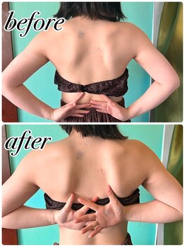 ルルマル(lulumalu)/肩コリでお悩みの方