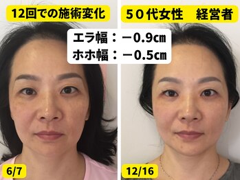 凛と慶/40代女性の施術変化
