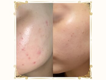 ベルーム(BellRoom)/