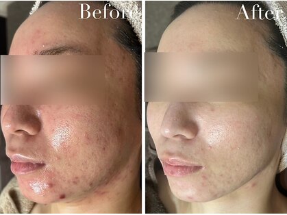アヴニールブリヨン 恵比寿(Avenir Brillant)の写真