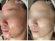 アヴニールブリヨン 恵比寿(Avenir Brillant)の写真