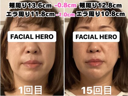 フェイシャルヒーロー 大阪北堀江店(Facial Hero)の写真