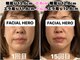 フェイシャルヒーロー 大阪北堀江店(Facial Hero)の写真