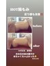 夏前にお腹スッキリ！！大人気！！【HOT腸もみ】¥14,300→¥13,800