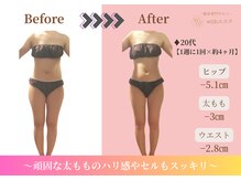 ウィズエステ(withエステ)の雰囲気(【ダイエット】体型のお悩み、お任せください)