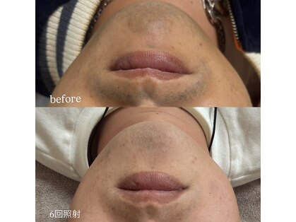 シュカ(Shuka)の写真