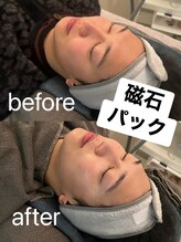 サリエ(S'allier)/最強な磁石パック！！