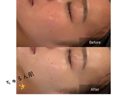 マインエム(mine.m)の写真