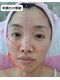 リアウェイク(Reawayke)の写真/ラジオ波でたるみを引き上げる技術が魅力！ほうれい線を目立たなくするケアを♪