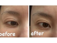 リジュベネ(rejuvena)/目の開きが変わります♪