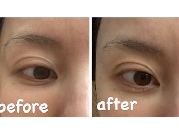 リジュベネ(rejuvena)/目の開きが変わります♪