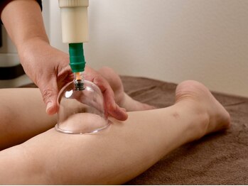 グッド エステ(Good)/下半身痩身のカッピング