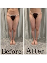 ブーケ/フェムケア　Before & After