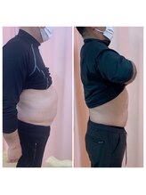 マイティー整骨院 ココア(CoCoa)/痩身マシン