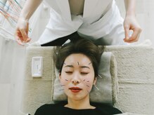 アキュネ 福岡薬院店(acune)/福岡/薬院/美容鍼/美肌