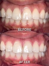 ライトビューティー 池袋店(LightBeauty)/症例写真