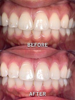 ライトビューティー 池袋店(LightBeauty)/症例写真