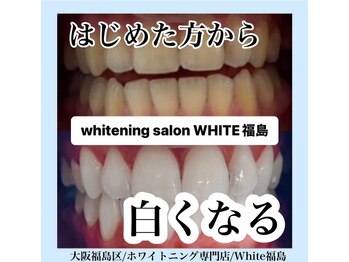 ホワイトニングサロン ホワイト(WHITE)/セルフホワイトニング/大阪/福島
