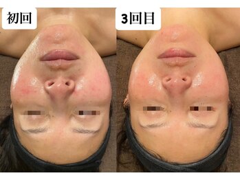 ディサイドロー(DECIDE L.A.W)/必ず変わる！