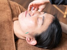 グリーンルーム鍼灸院 接骨院 戸塚院(GREENROOM鍼灸院 接骨院)/美容鍼