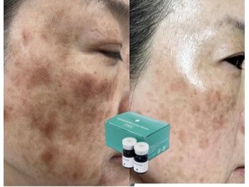 フィオリトゥーラ ガーデン 茨木店