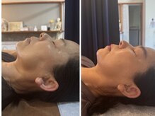 ジョーヌ(JAUNE)/別人級の横顔美人へ