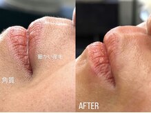 アイロンボーイ(IRONBOY)/艶肌お顔全体WAX