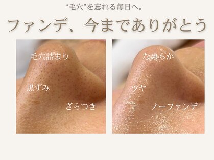 アヘッド(AHEAD)の写真
