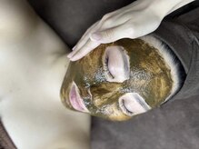 ラヴィオス 渋谷表参道店(RAVIOS)/肌質改善/ハーブピーリング