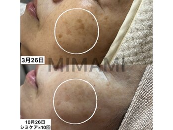 ミナミ(MINAMI)/色のトーンもしっかりアプローチ