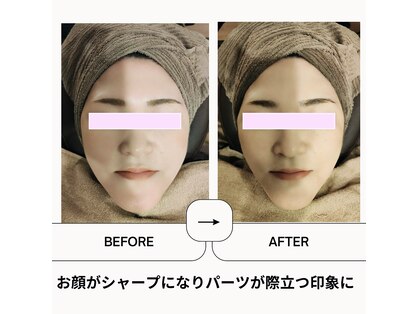 ボディトーン(bodytone)の写真
