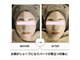 ボディトーン(bodytone)の写真