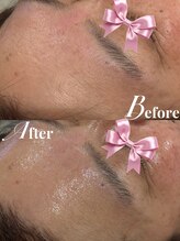 リリーミー(Rily Me)/Gloss肌トリートメント