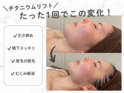 クレスト(CLEST.)の写真