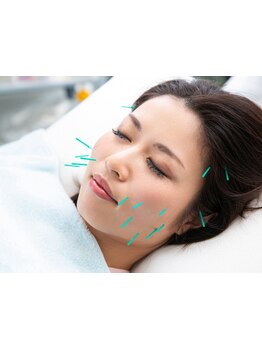 小顔になりたい