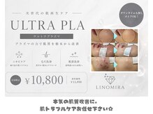 リノミラ(LINOMIRA)