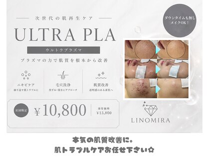 リノミラ(LINOMIRA)の写真