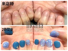 モアナ 池袋(MOANA)/人工深爪