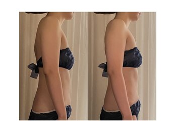 サロン ド プリヴェ(Salon de PRIVE)/マシン×ハンドでハミ肉解消!