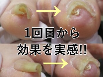 立川巻爪補正院