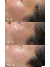 フーフラット(Huu flat)/フェイシャルワックス