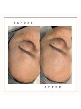 ペイジ(page)/【プラピール】before→after