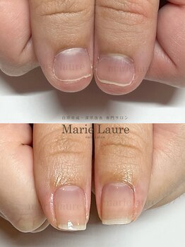 マリーロール 淀屋橋本店(Marie Laure)/深爪矯正/自爪育成/ネイルケア