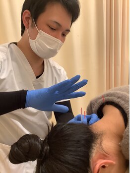 小松島坂口鍼灸整骨院/頭痛改善