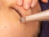 【ニキビ・跡・毛穴・小ジワがふっくら整う】エステでできるダーマケア