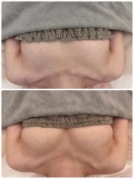 美人バスト 浜松店/◆バストアップ &nbsp;BeforeAfter◆