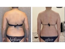 TMサロン 赤坂の雰囲気（もっこり肩は骨盤のゆがみやお腹周りも原因が。インナーケア）