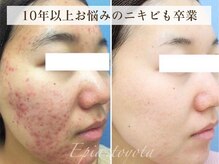 エピア 豊田店(Epia)