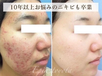 エピア 豊田店(Epia)の写真