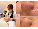 フォトビズの写真/肌育サロン【毛穴レス＆艶肌肌育】フォト＋ハイドラ毛穴洗浄+ヒト幹細胞+高濃度パック8800円が人気